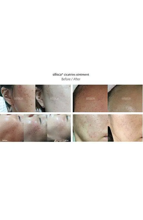SILISCA RH-OLIGOPEPTIDE-1 Cream