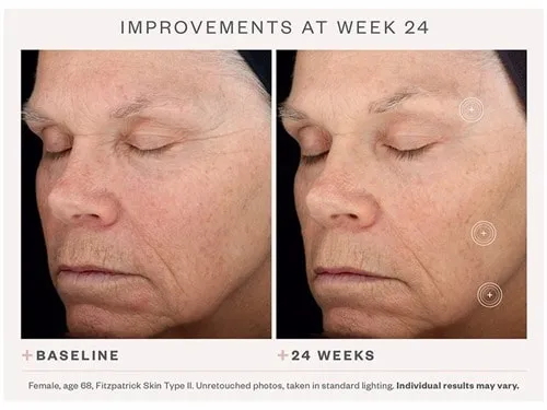 SkinMedica TNS® Advanced  Serum