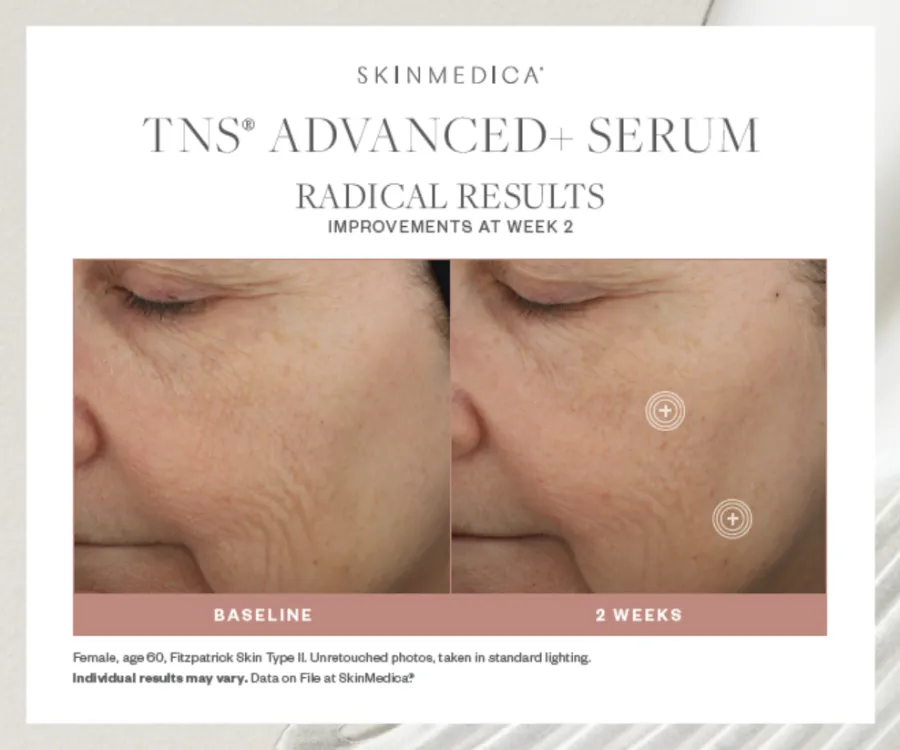 SkinMedica TNS Advanced  Serum
