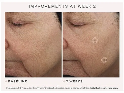 SkinMedica TNS® Advanced  Serum